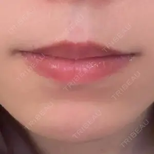 東京美容皮膚科アロエクリニック 東京美容皮膚科アロエクリニック池袋口コミ