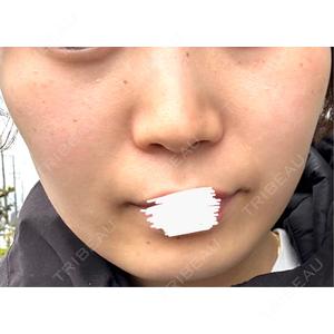 ルラ美容クリニック ルラ美容クリニック 静岡院口コミ
