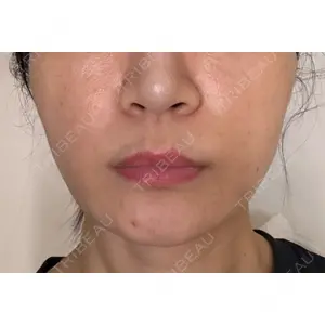 グレーススキンクリニック グレーススキンクリニック口コミ