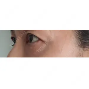 LOCHIC CLINIC GINZA【ロシッククリニック銀座】口コミ