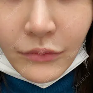 KARIS beauty clinic口コミ