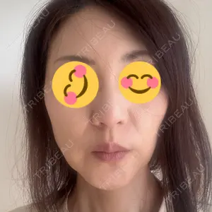 TCB東京中央美容外科 TCB東京中央美容外科 神戸院口コミ