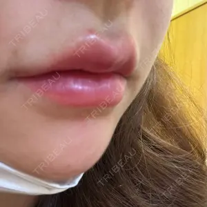 口コミ