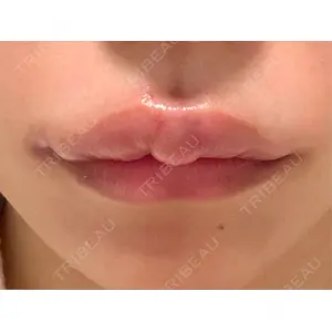 フィラークリニック フィラークリニック 名古屋栄院口コミ