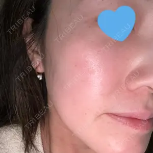 ルラ美容クリニック ルラ美容クリニック 名古屋本院口コミ