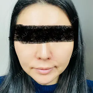 HAAB CLINIC HAAB×DREAM BEAUTY CLINIC 東京本院口コミ