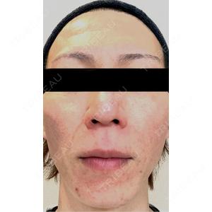 ルラ美容クリニック ルラ美容クリニック 名古屋本院口コミ