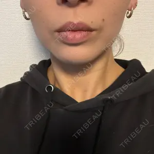 口コミ