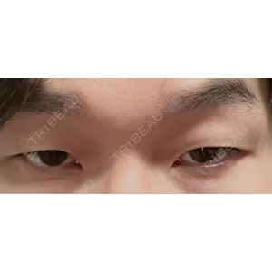 東京イセアクリニック口コミ