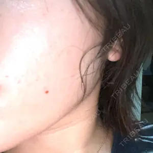 南青山コスメクリニック口コミ