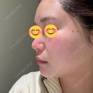 BITO BEAUTY CLINIC BITO BEAUTY CLINIC口コミ