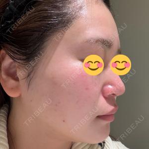 BITO BEAUTY CLINIC BITO BEAUTY CLINIC口コミ