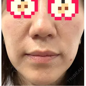 BISIN GINZA CLINIC口コミ