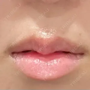 ECLA CLINIC ECLA CLINIC (エクラクリニック)口コミ