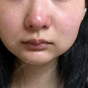 CHARIS BEAUTY CLINIC口コミ
