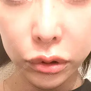 口コミ