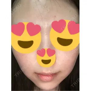 美容皮膚科ティファクリニック 美容皮膚科ティファクリニック 新宿東口口コミ