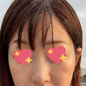 グランジョイクリニック口コミ