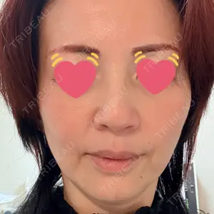 美容皮膚科ティファクリニック 美容皮膚科ティファクリニック 新宿東口口コミ