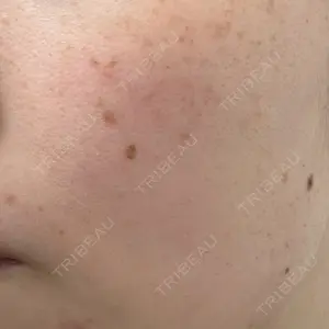 ルラ美容クリニック ルラ美容クリニック 大宮院 / ルラスキンクリニック 大宮院口コミ