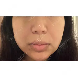 Fellez Clinic【フェルズクリニック】口コミ