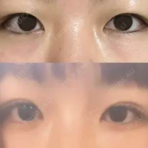 LUHO（ルホ）美容外科口コミ