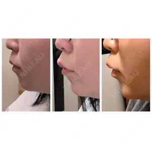 HINATA クリニック口コミ