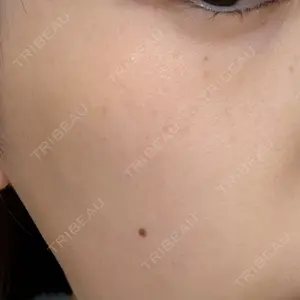 ルラ美容クリニック ルラ美容クリニック 名古屋本院口コミ
