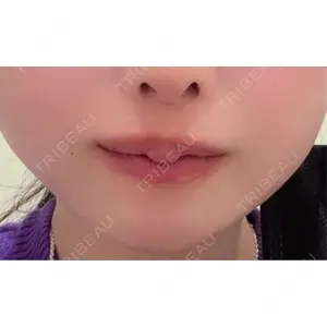 フィラークリニック フィラークリニック 新宿院口コミ