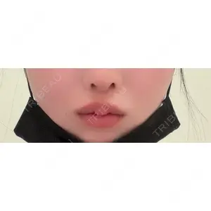 フィラークリニック フィラークリニック 新宿院口コミ