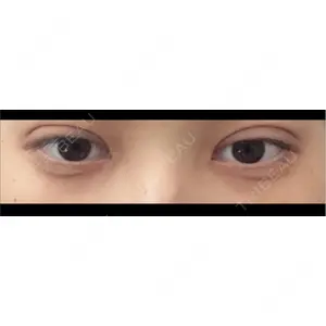 東京シンデレラ美容外科 東京シンデレラ美容外科 池袋院口コミ