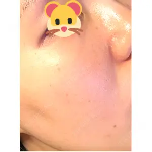 APスキンクリニック銀座口コミ