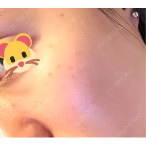 APスキンクリニック銀座口コミ