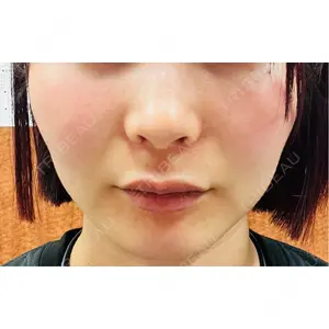 CZEN CLINIC 銀座院口コミ