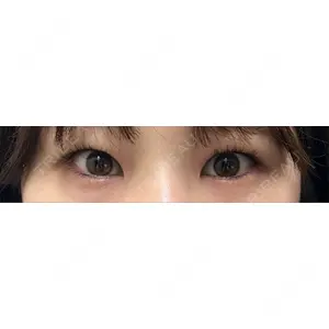 口コミ
