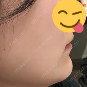 口コミ