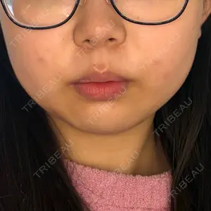 東京美容皮膚科アロエクリニック 東京美容皮膚科アロエクリニック池袋口コミ