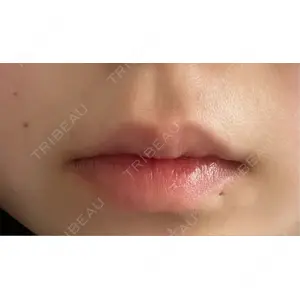 池袋美容クリニック 池袋美容クリニック口コミ