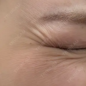 TCB東京中央美容外科 TCB東京中央美容外科 銀座有楽町院口コミ