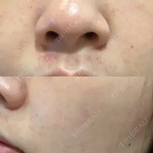 東京美容皮膚科アロエクリニック 東京美容皮膚科アロエクリニック池袋口コミ