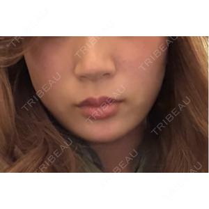 東京美容外科 東京美容外科 福岡院口コミ