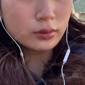 東京美容外科 東京美容外科 福岡院口コミ