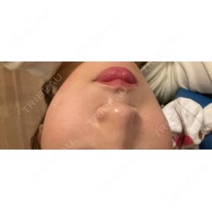 東京美容外科 東京美容外科 福岡院口コミ
