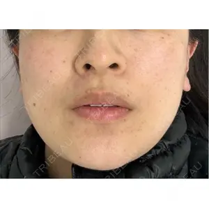 ルラ美容クリニック ルラ美容クリニック 渋谷本院口コミ