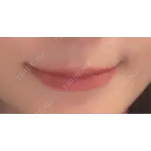 口コミ