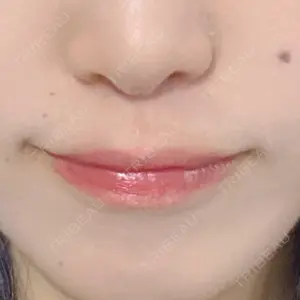 ルラ美容クリニック ルラ美容クリニック 渋谷本院口コミ