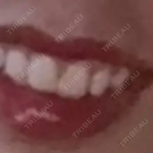 プロクリニック PRO CLINIC プロクリニック 銀座院口コミ