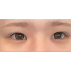 口コミ
