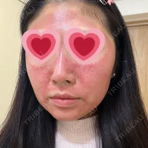 東京美容皮膚科アロエクリニック 東京美容皮膚科アロエクリニック池袋口コミ