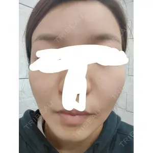 APスキンクリニック銀座口コミ